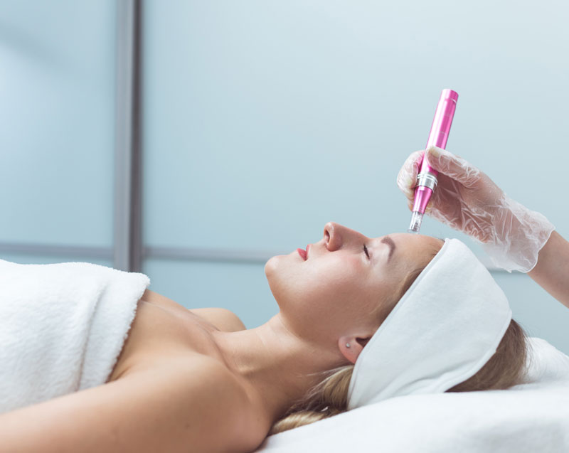 Entspannte Patientin genießt eine professionelle Microneedling-Behandlung in der Praxis Nina Bettge, wobei ein spezialisiertes rosa Microneedling-Gerät sanft über die Gesichtshaut geführt wird."